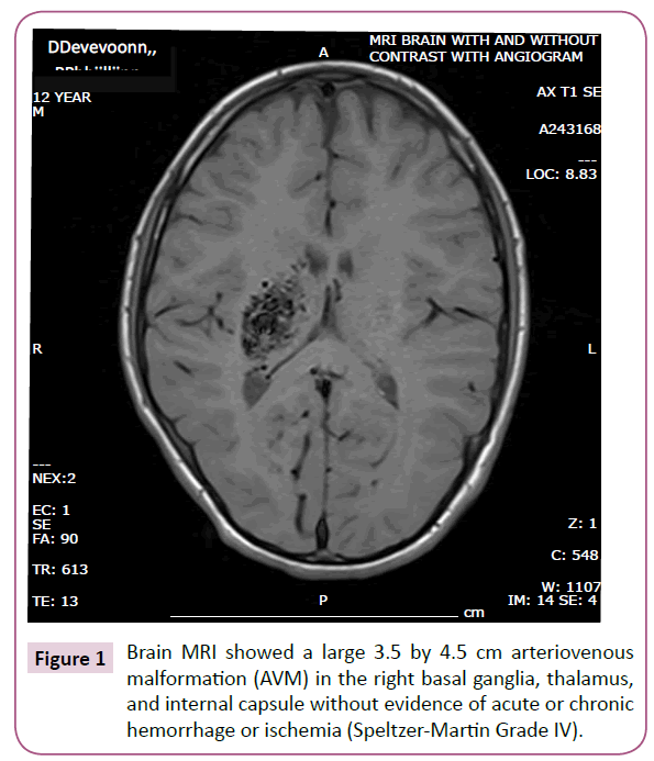 childhood-developmental-disorders-Brain-MRI