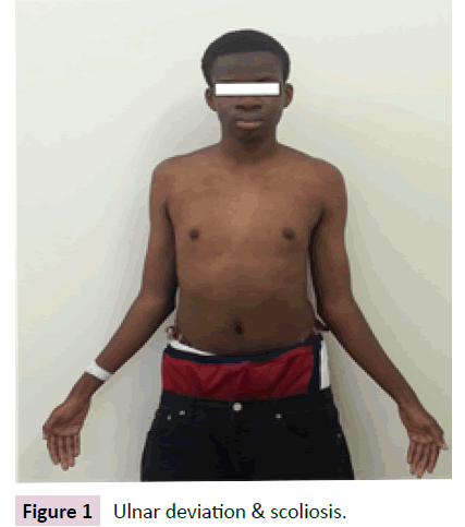 427px x 483px - Problematic Sexual Behavior in a Patient of 48, XXYY Syndrome: A Case  Report | Insight Medical Publishing